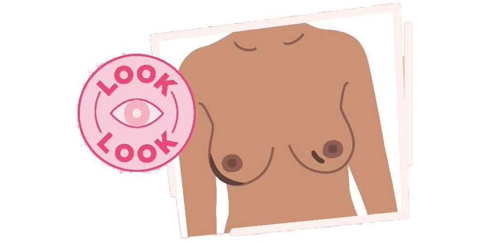 Image of breasts with lumps