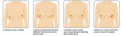 Be Your Breast Friend