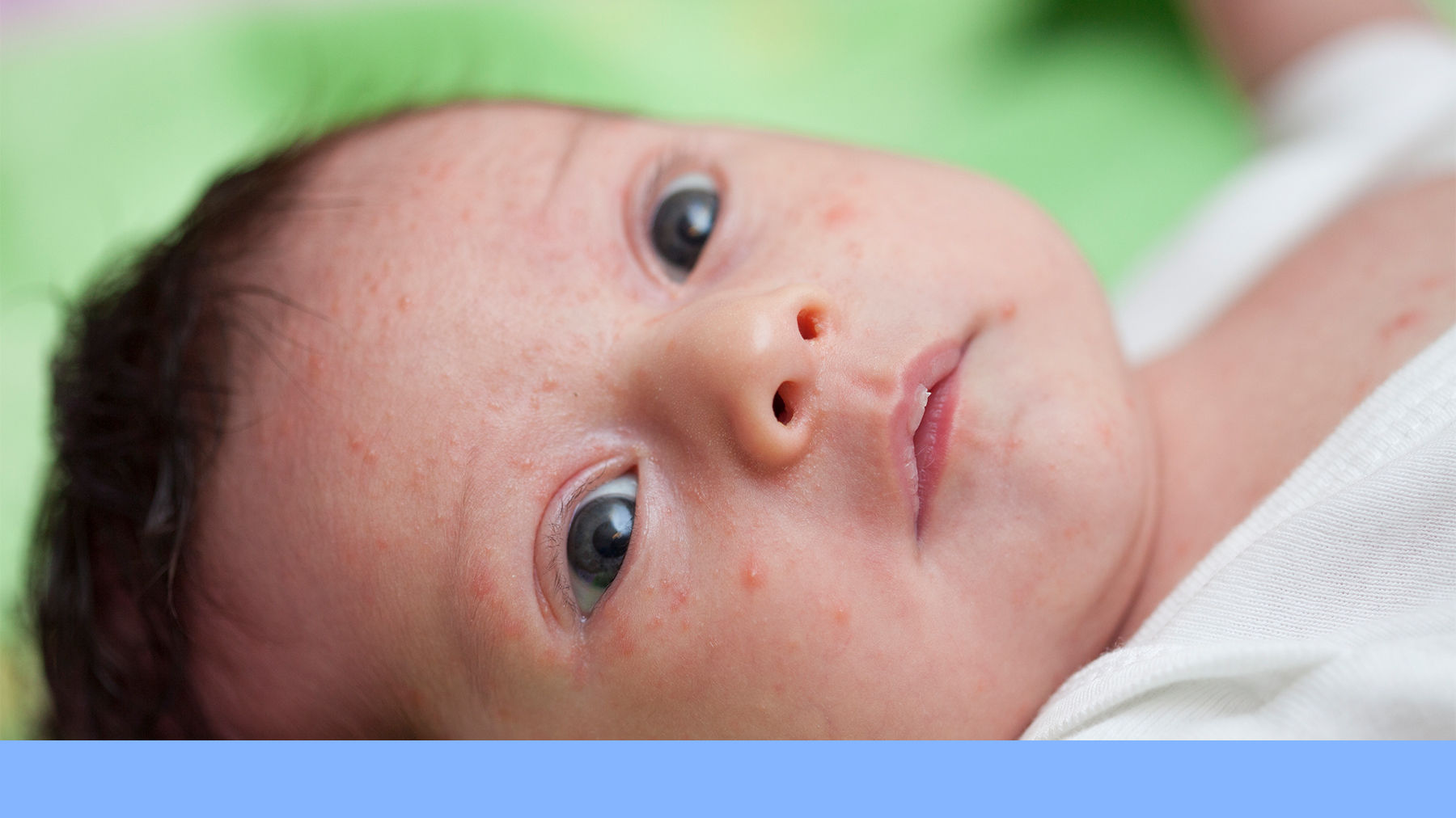 Baby with a spots on their face