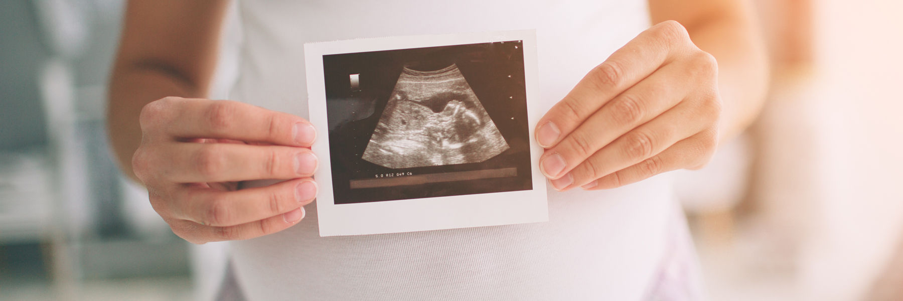 Pregnancy 3D scan